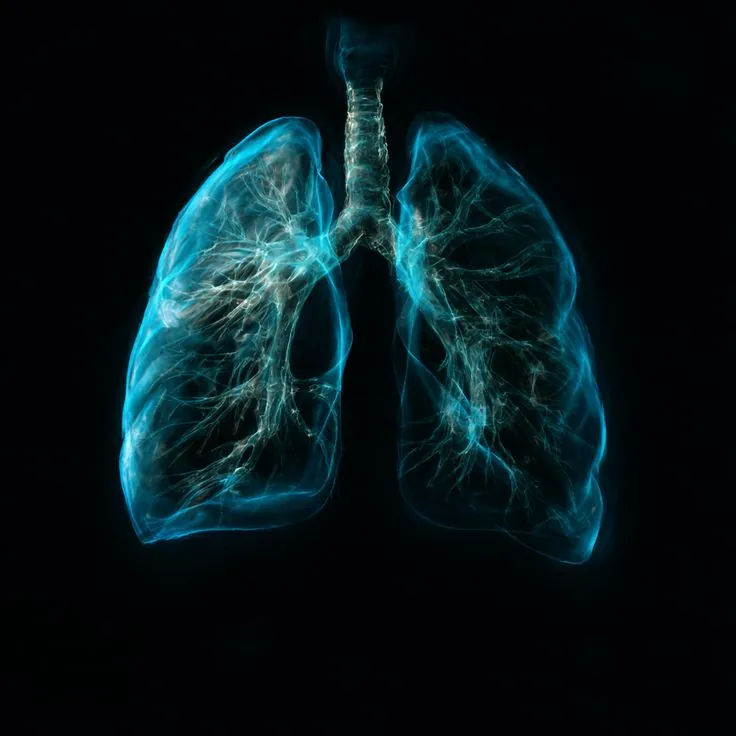 Illustrative image: COPD